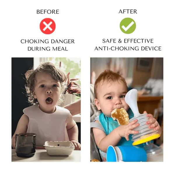 Trendoro™ ANTI-CHOKING DEVICE